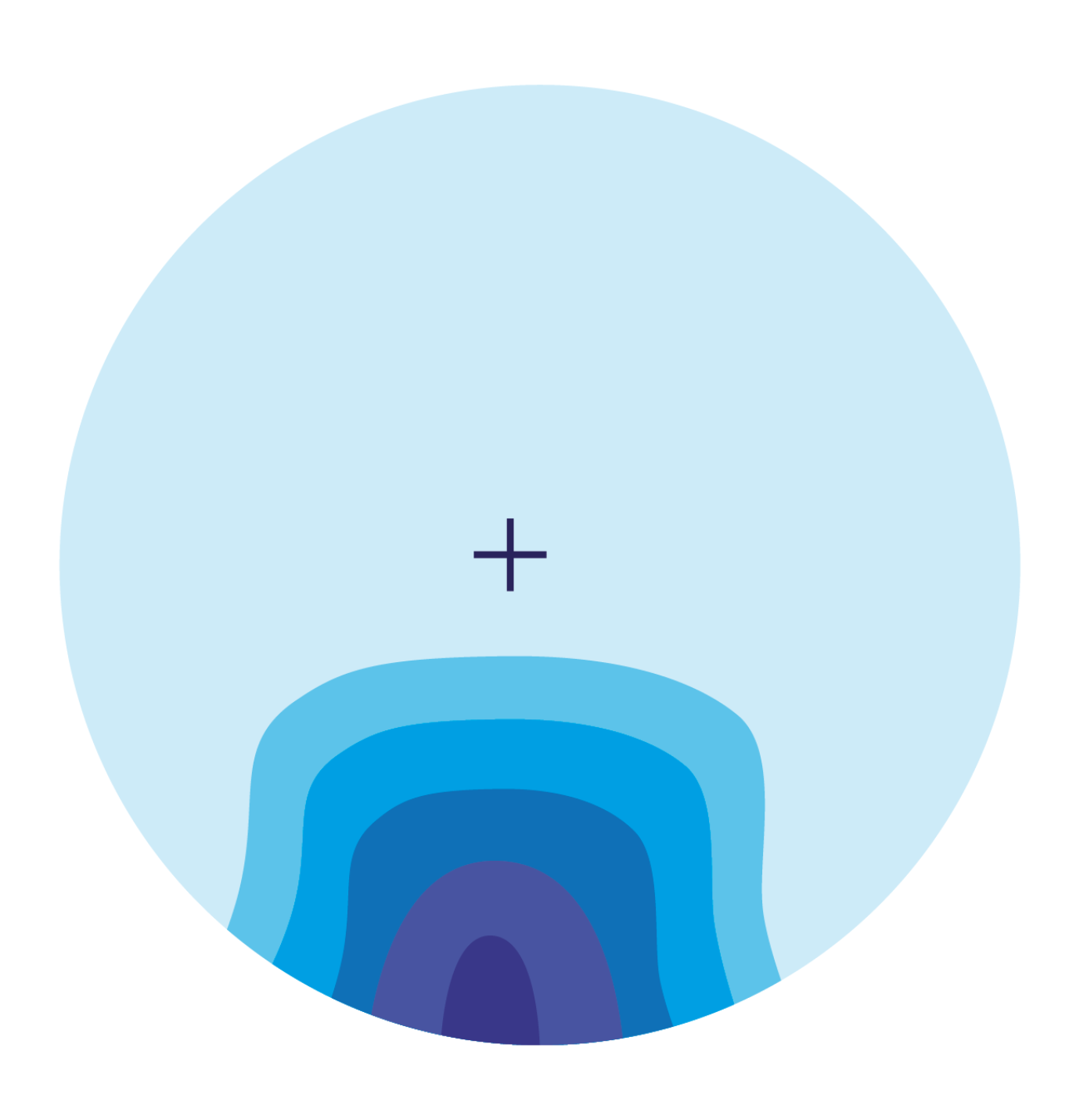 Steady Plus Methodology spherical equivalent distribution